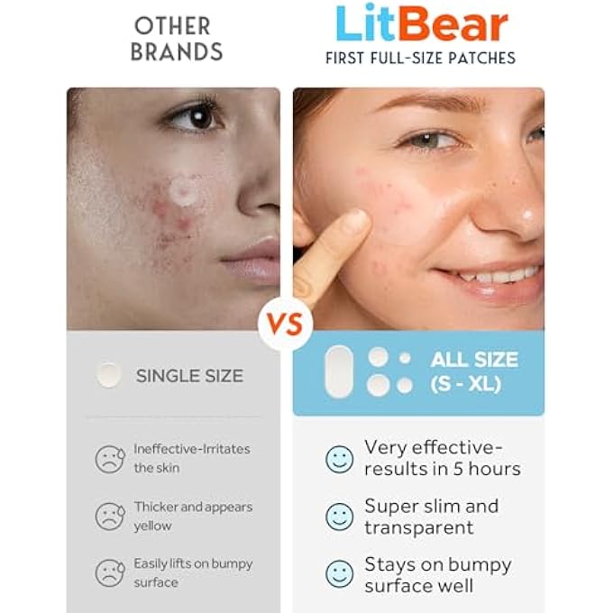 LitBear LARGE ACNE PIMPLE PATCHES, 5 SIZES 80 PATCHES FOR LARGE BREAKOUTS, ACNE PATCHES FOR FACE, CHIN OR BODY, ACNE SPOT PATCH WITH TEA TREE & CALENDULA OIL, HYDROCOLLOID BANDAGES FOR ACNE SKIN - Image 3